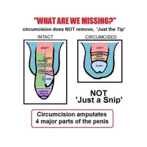 dick pictures|Circumcision Picture and Photo Gallery